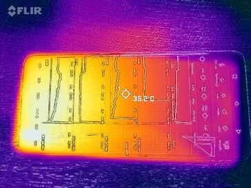 Thermal imaging: front