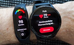 The Xiaomi Smart Band 7 only detects pulse fluctuations to a limited extent