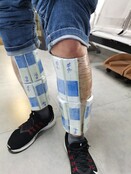 Taped to calves. (Image source: HKEPC)