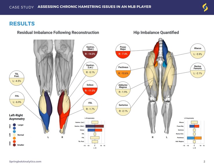 Springbok Analytics reports detail individual muscles through 3D MRI scans. (Source: Springbok Analytics)