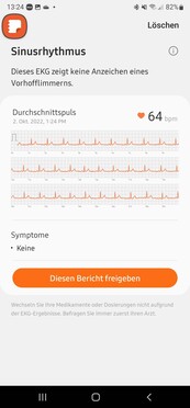 Blood pressure measurement and ECG work through a third app, called Samsung Health Monitor