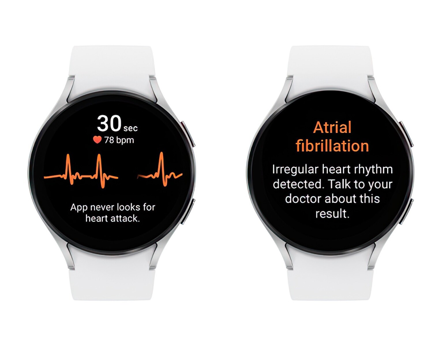 Samsung to bring passive irregular heart rate detection to Galaxy Watch4 Galaxy Watch5 and Galaxy Watch6 series NotebookCheck News