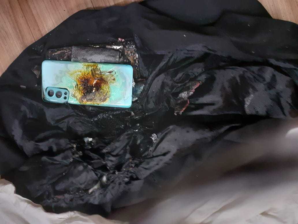 Shocking! OnePlus Nord 2 Battery Explodes And Catches Fire, Woman in  Physical Trauma