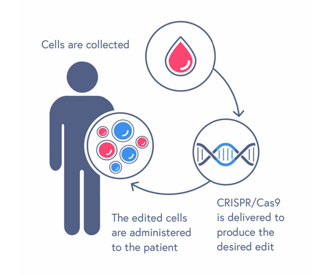 Vertex and CRISPR Therapeutics gain FDA approval for CASGEVY World’s
