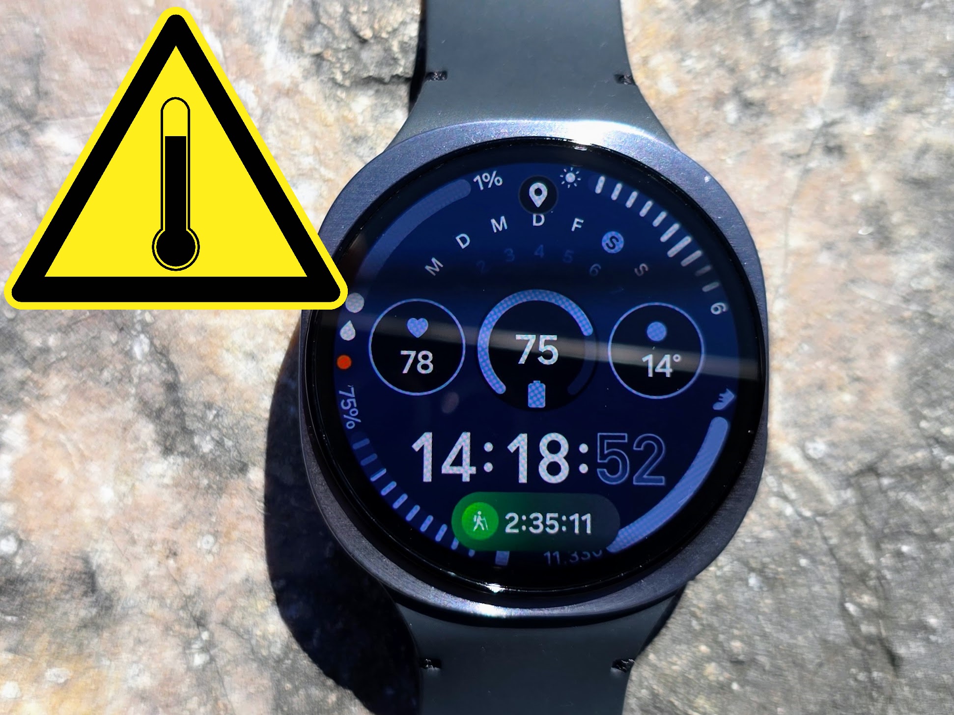 Galaxy Watch 8 burns user badly leaving visible scar as Samsung dismisses case