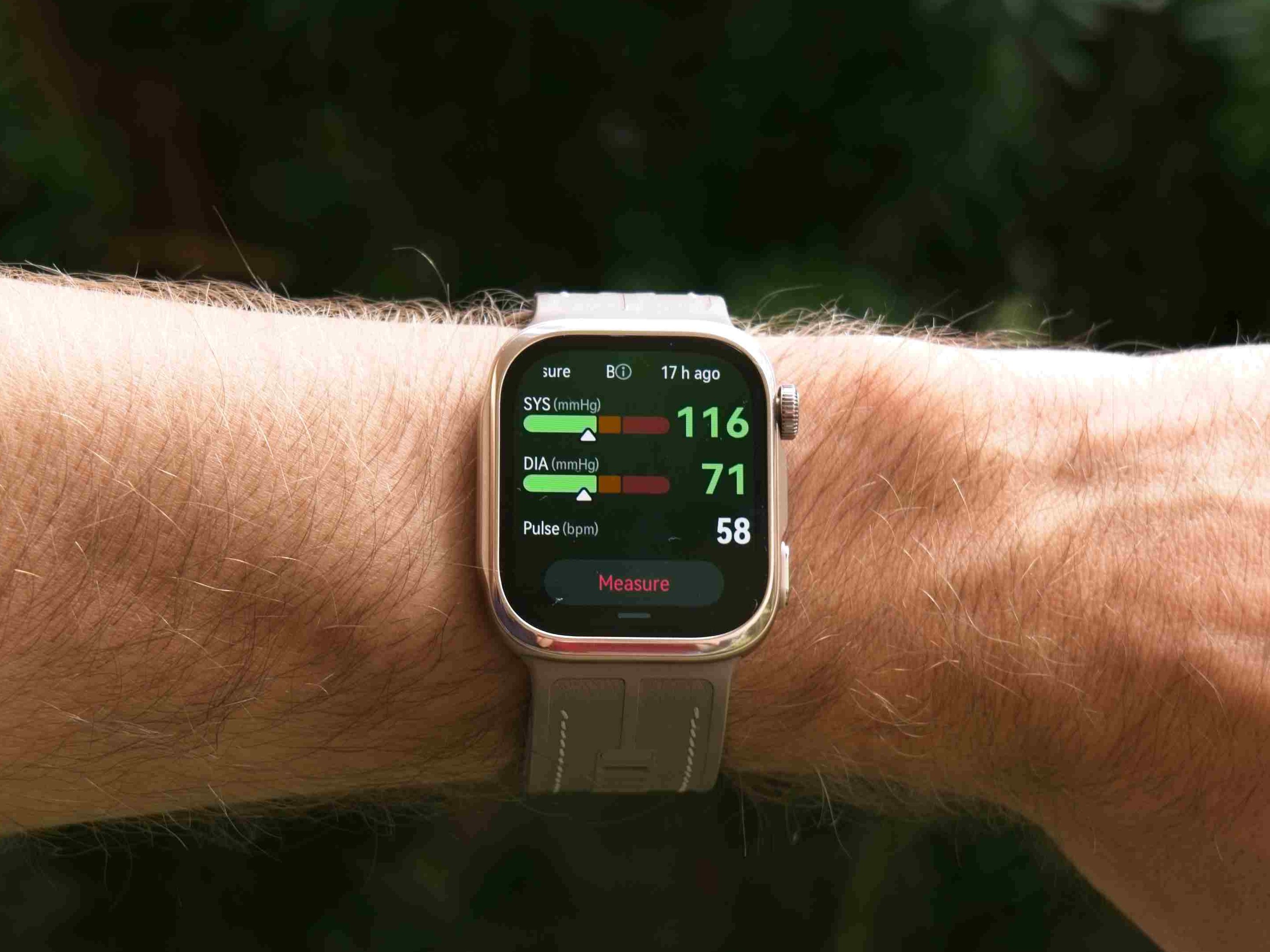 Huawei Watch D3 review: How the smartwatch measures arterial stiffness