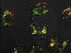 Using spherical nucleic acids, the compound 5-fluorouracil showed up to 20,000 times higher effectiveness in animal studies. (Image source: Northwestern University)