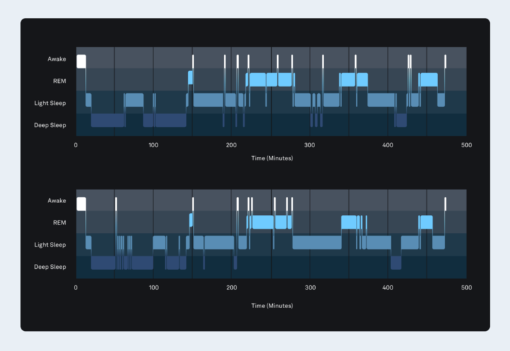 The new Oura sleep staging algorithm (bottom) is shown here to be 84% accurate compared to the polysomnography (top). (Image source: Oura)