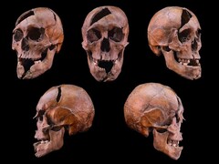 The skull of the investigated individual from the 13th century Dominican monastery on Margaret Island, Budapest (Image Credit: Eötvös Loránd University)