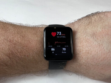 Xiaomi Redmi Watch 2 Lite Smartwatch Review: Improved successor of the  Xiaomi Watch Lite - NotebookCheck.net Reviews