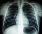 An X-ray image of a human torso (Image source: Umanoide via Unsplash; cropped)