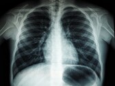 An X-ray image of a human torso (Image source: Umanoide via Unsplash; cropped)