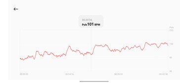 Heart Rate Monitoring with the Xiaomi Smart Band 10 Pro