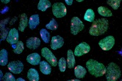 An image showing stem cells obtained from a woman's skin (Image source: UCLA via CIRM)
