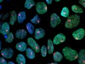 An image showing stem cells obtained from a woman's skin (Image source: UCLA via CIRM)