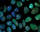 An image showing stem cells obtained from a woman's skin (Image source: UCLA via CIRM)