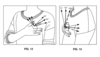 A Fitbit patent shows details of a potential blood pressure finger monitor. (Image source: USPTO)