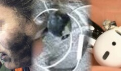 The fatal earphones blast is the latest shocking device failure involving personal audio equipment. (Image source: Neowin/Times of India/WFLA - edited)