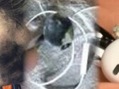 The fatal earphones blast is the latest shocking device failure involving personal audio equipment. (Image source: Neowin/Times of India/WFLA - edited)