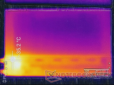 Surface temperature (back)