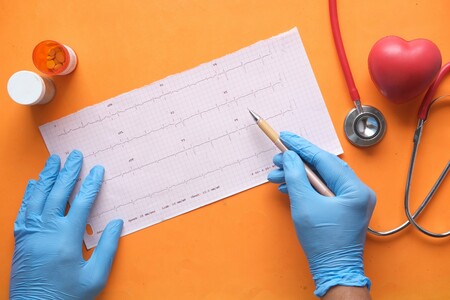 Illustrative image: This is what a multi-lead ECG looks like—interpreting it with pen and paper is still not entirely uncommon.