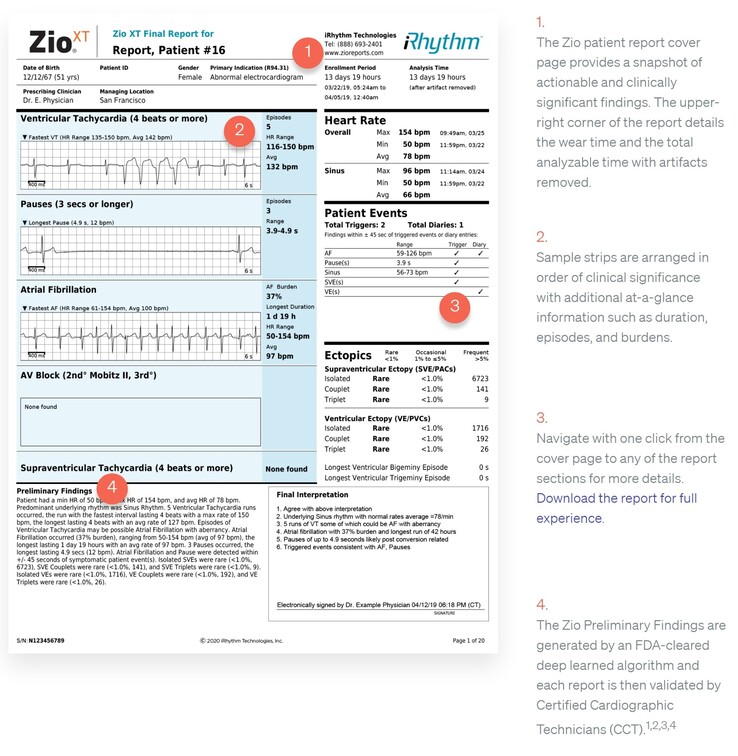 ECG reports provide a clear, AI analysis of a patient's heart condition. (Source: iRhythm Technologies)