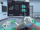 The STELLAR Knee interface displaying the calculated dimensions and positions of leg bones during knee surgery. (Source: PolarisAR on Youtube)