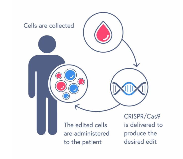 CASGEVY treatment process involves transfusing edited blood stem cells. (Source: CRISPR Therapeutics)