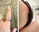 A Samsung Galaxy Ring with a swollen battery forced a user to make a trip to the hospital. (Image source: Zone of Tech)