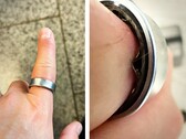 A Samsung Galaxy Ring with a swollen battery forced a user to make a trip to the hospital. (Image source: Zone of Tech)