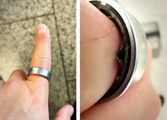 A Samsung Galaxy Ring with a swollen battery forced a user to make a trip to the hospital. (Image source: Zone of Tech)