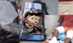 The Oppo A53 allegedly exploded, leaving its owner with injuries to both of his legs. (Image source: Technical Dost - edited)