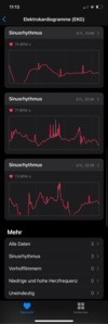 ECG stats