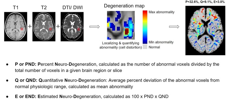 BrainSee can detect abnomal areas of the brain from a MRI scan and give doctors a score indicating the likelihood of a patient developing Alzheimer's. (Source: Darmiyan)