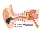APG uses ultrasonic tones modulated by pressure changes in the ear canal (Image Source: Google Research)
