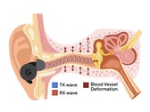 APG uses ultrasonic tones modulated by pressure changes in the ear canal (Image Source: Google Research)