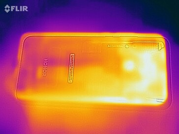 Thermal image - Back