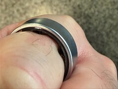 Swollen Samsung Galaxy Ring on a user's finger. (Image source: Daniel on X)
