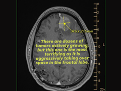 A scan from Michael Prinke's MRI as uploaded by his wife on social media