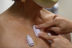 NWU wearable sensor enables continous, remote monitoring of vitals including breathing issues. (Source: Northwestern University press release)