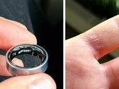 A swollen battery in a Galaxy Ring can be painful. (Image source: Zone of Tech)