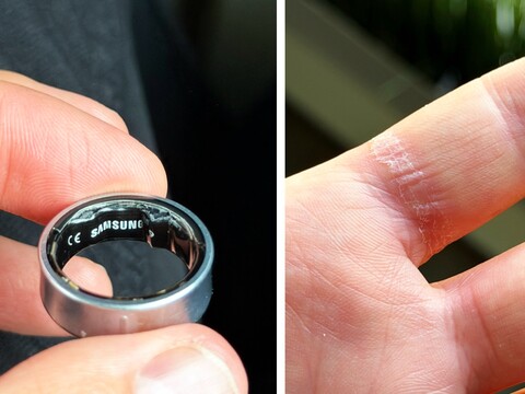 A swollen battery in a Galaxy Ring can be painful. (Image source: Zone of Tech)