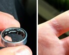 A swollen battery in a Galaxy Ring can be painful. (Image source: Zone of Tech)