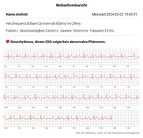 The iHEAL 6's ECG recordings are decent
