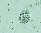Toxoplasma gondii shown here in its infectious egglike form. (Image source: Todorean Gabriel/iStock/Getty Images Plus)