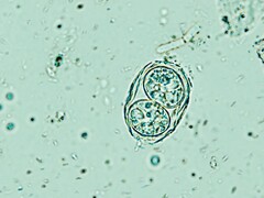 Toxoplasma gondii shown here in its infectious egglike form. (Image source: Todorean Gabriel/iStock/Getty Images Plus)
