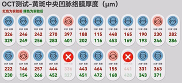 Based on an internal Honor study, there was a positive effect on temporary myopia as measured by chorodial thickness in the back of the eye for most participants. (Image source: 胜利文绉绉 on BiliBili)