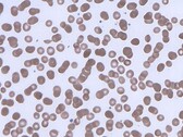Red blood cells forming rouleaux. (Image source: Wikimedia Commons)