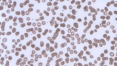 Red blood cells forming rouleaux. (Image source: Wikimedia Commons)