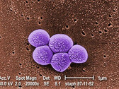 Integrated Biosciences discovers new class of antibiotics effective against resistant MRSA bacteria. (Source: Public Health Image Library #9994)